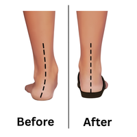 Pathway Pro™ Acupressure Insoles